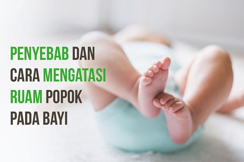 Cara Mengatasi Ruam Popok Pada Bayi