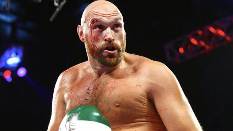 tyson-fury (cbssports com)