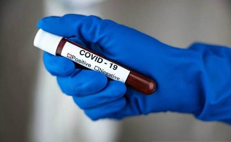 rapid test-covid