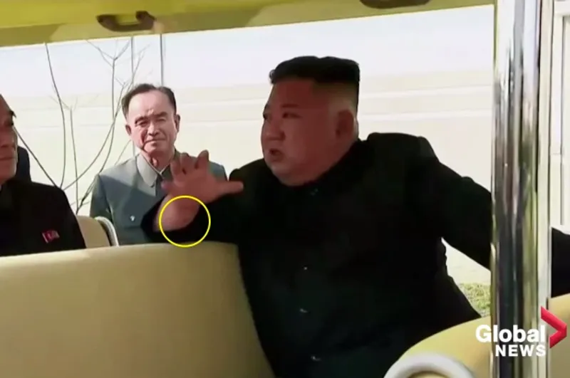 kim jong un