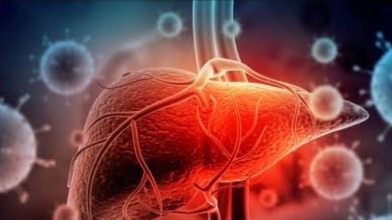 36865-hepatitis-akut-misterius-antara
