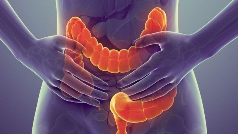 Kanker-usus-besar-deteksi-dini-dan-yang-perlu-diketahui