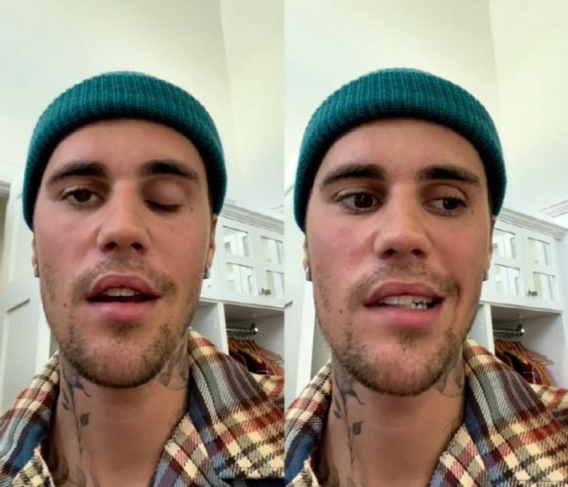 Karena 'Ramsay Hunt Syndrome' Justin Bieber Tunda Semua Konsernya