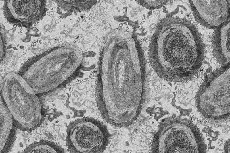 ilustrasi virus cacar monyet Mpox Swedia