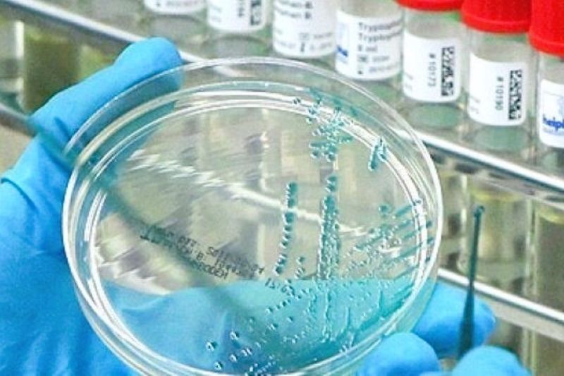 Sebuah kasus langka infeksi flu burung subtipe A(H5N1) pada manusia telah dilaporkan di Inggris