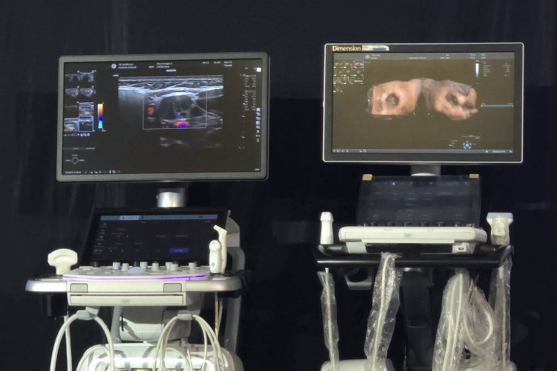 Dua produk ultrasonografi (USG) oleh GE Healthcare alat kesehatan