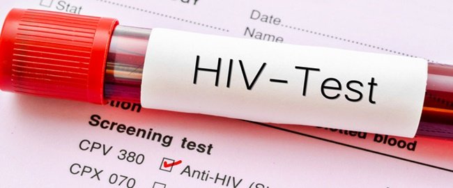 HIV