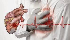 Satu-Bulan-Sebelum-Serangan-Jantung-Menyerang-Tubuh-Kita-Perhatikan-6-Tanda-ini-doc.jantung-ivoox.id_
