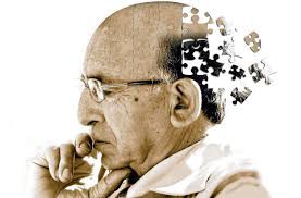 alzheimer
