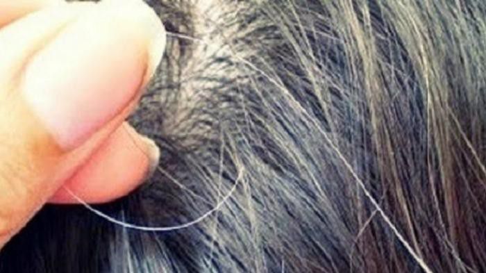 Stres-Salah-Satu-Pemicu-Tumbuhnya-Uban-Sebelum-Waktunya-doc.Uban-ivoox.id_