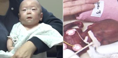bayi terkecil